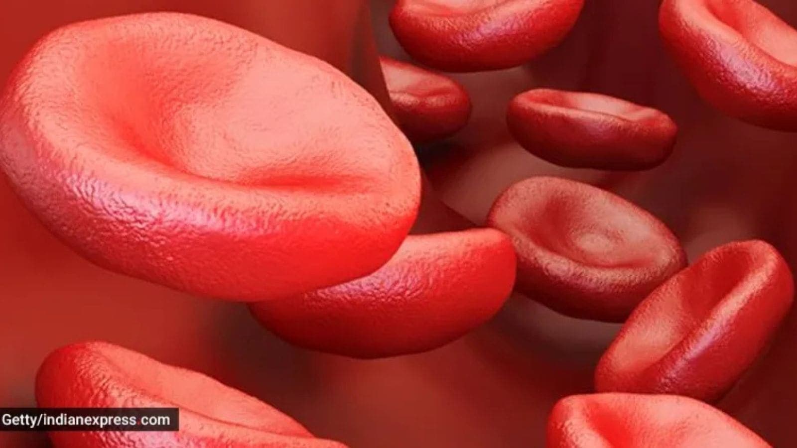 Breaking the Silence: Hurdles in Newborn Sickle Cell Screening Across India’s Tribal Belts