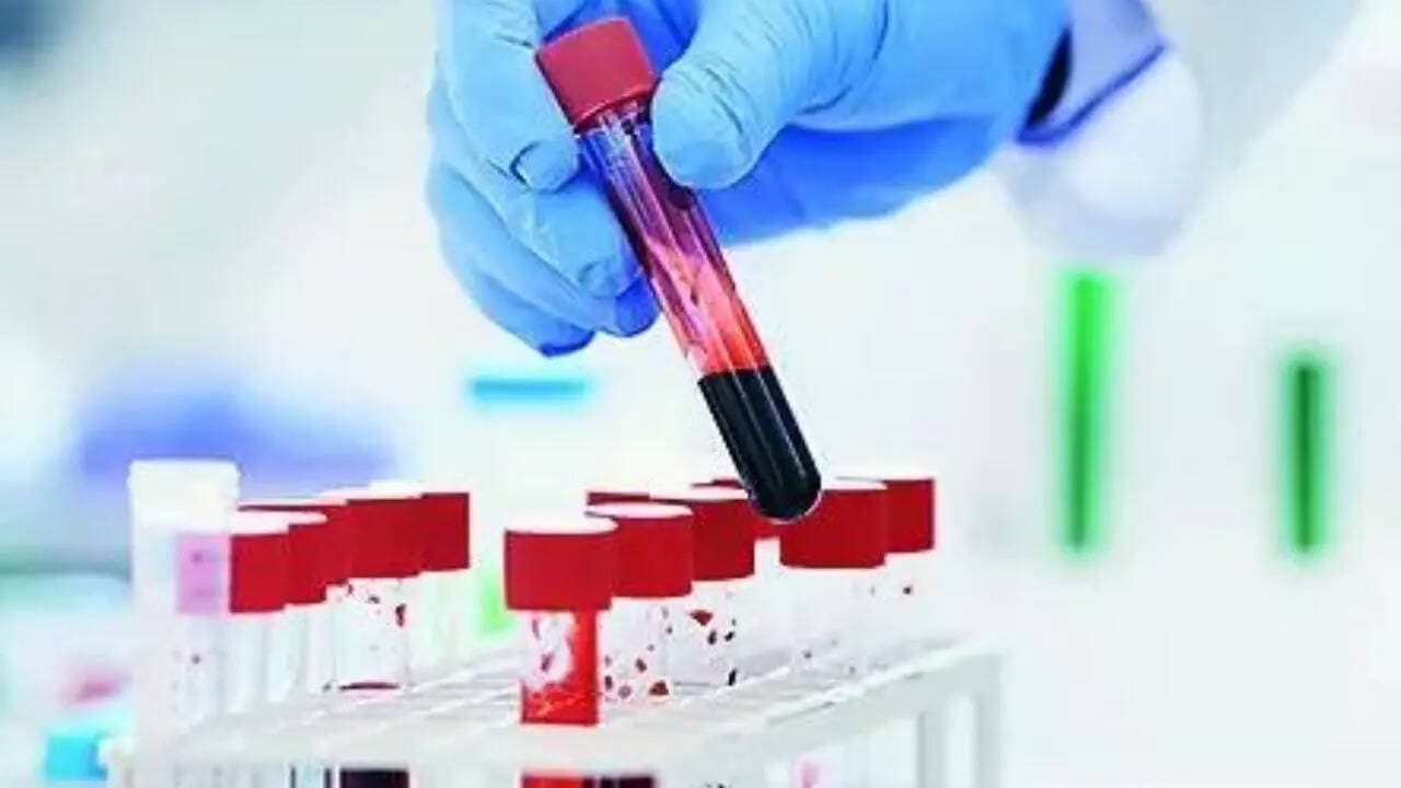 New Blood Test Could Predict Lung Cancer Risk Five Years Before Diagnosis